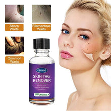 Charger l&#39;image dans la galerie, Foreign Trade Cross-Border Eelhoe Skin Verrucous Remover To Solve Skin Verrucous - stancevita
