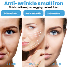 Lade das Bild in den Galerie-Viewer, Hyaluronic Acid Skin Care Tools - stancevita
