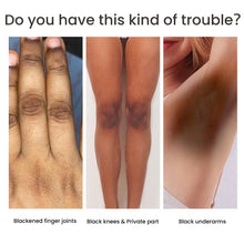 Lade das Bild in den Galerie-Viewer, Women&#39;s Skin Pigmentation Care - stancevita

