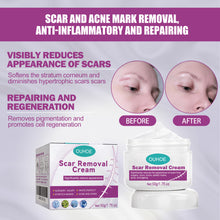 Lade das Bild in den Galerie-Viewer, Fade Scars Skin Care Moisturizing Smooth Skin Facial Neck Cream - stancevita
