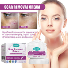Lade das Bild in den Galerie-Viewer, Fade Scars Skin Care Moisturizing Smooth Skin Facial Neck Cream - stancevita
