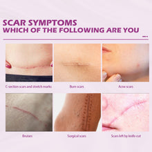 Lade das Bild in den Galerie-Viewer, Fade Scars Skin Care Moisturizing Smooth Skin Facial Neck Cream - stancevita
