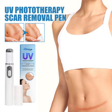 Lade das Bild in den Galerie-Viewer, UV Light Scar Pen Gentle Fade Repair Skin Scar Smooth Skin Light Scar Pen - stancevita
