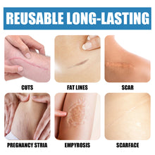Lade das Bild in den Galerie-Viewer, UV Light Scar Pen Gentle Fade Repair Skin Scar Smooth Skin Light Scar Pen - stancevita
