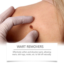 Lade das Bild in den Galerie-Viewer, Skin Care Cleaning Patch - stancevita
