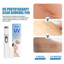Lade das Bild in den Galerie-Viewer, UV Light Scar Pen Gentle Fade Repair Skin Scar Smooth Skin Light Scar Pen - stancevita
