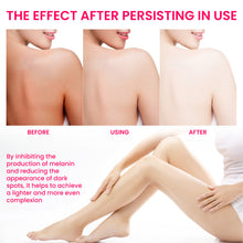 Lade das Bild in den Galerie-Viewer, Women&#39;s Skin Pigmentation Care - stancevita
